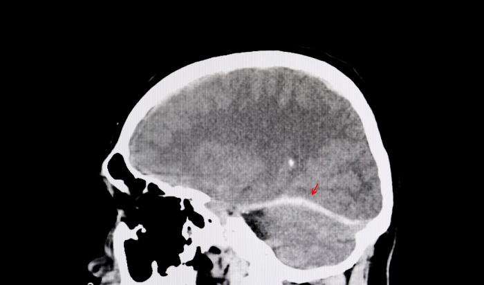 Do you have a serious brain injury?